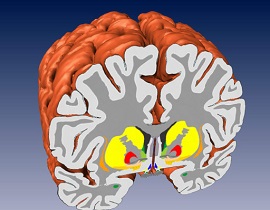 بازسازی سه بعدی مغز انسان با جزییات بی سابقه
